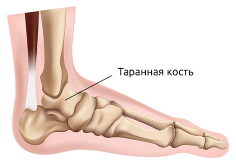 Операционные вмешательства и лечение проблем с таранной костью