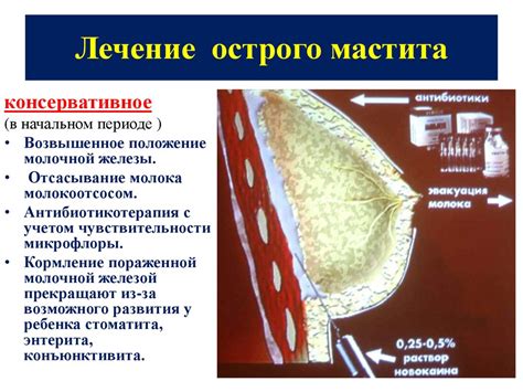 Операция молочной железы: суть и последствия