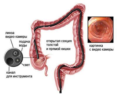 Опорожнение кишечника: польза и методы