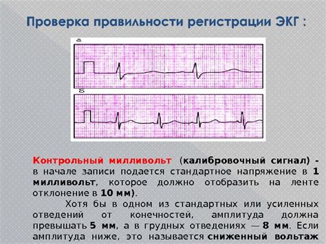 Определение ЭКГ и его значения