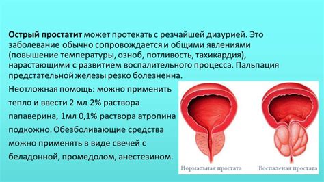 Определение воспалительных процессов по отделяемому мочеполовых органов