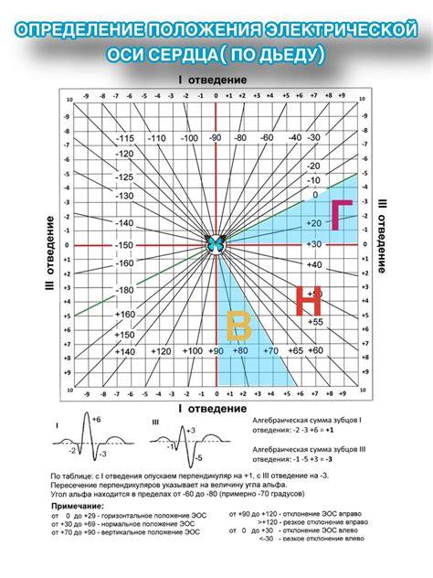 Определение горизонтальной электрической оси сердца