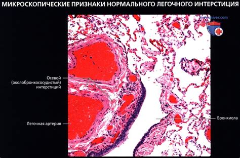 Определение интерстициальной ткани