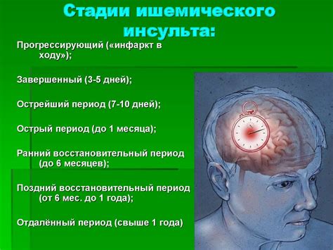 Определение ишемического инсульта