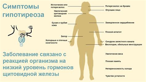 Определение и симптомы первичного гипотиреоза