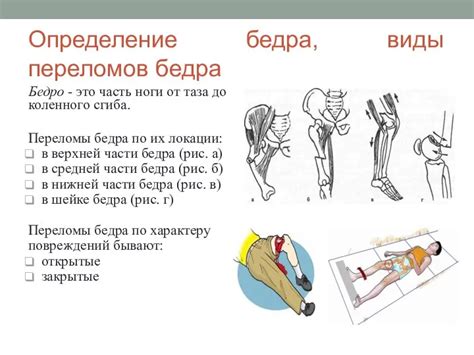 Определение понятия "привести бедро"