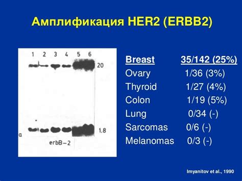 Определение сверхэкспрессии HER2