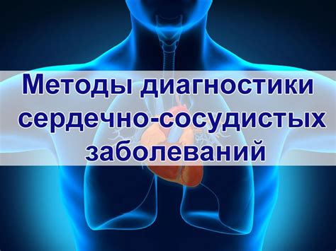 Определение тропонина и его значение для диагностики сердечно-сосудистых заболеваний