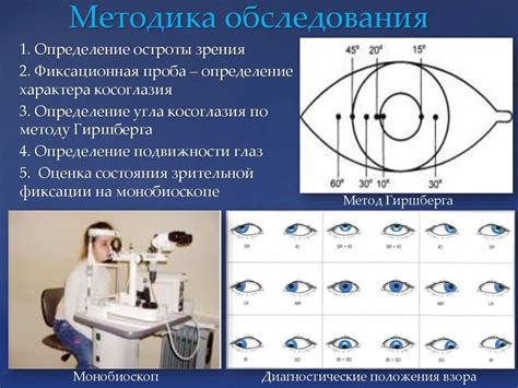 Определение угла косоглазия по гиршбергу