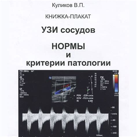 Определение ультразвукового исследования БЦС