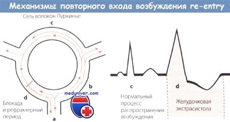 Определение RE-ENTRY и его особенности