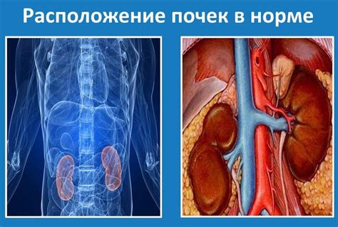 Опустить почки: понятие и причины смещения