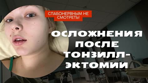 Осложнения, связанные с отсутствием миндалин