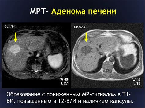 Осложнения диагностики и лечения