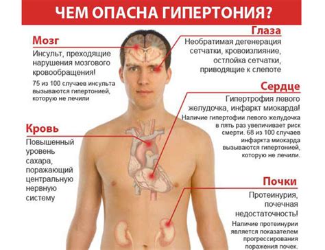 Осложнения махровой гипертонии