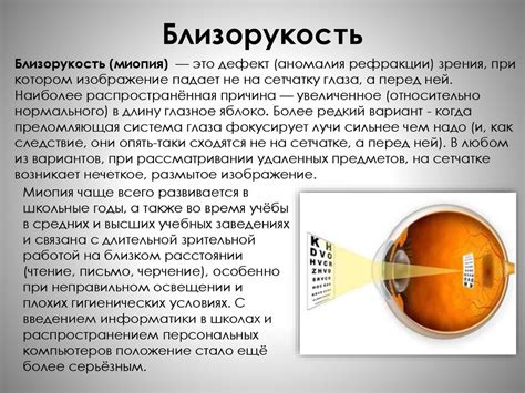 Осложнения миопии первой степени