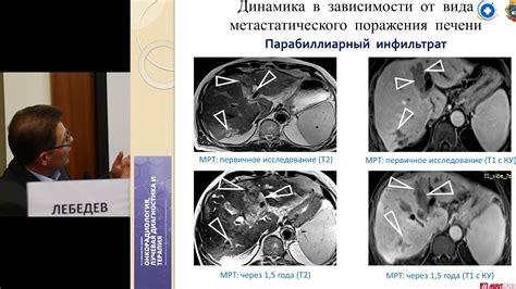 Осложнения отбитой печени