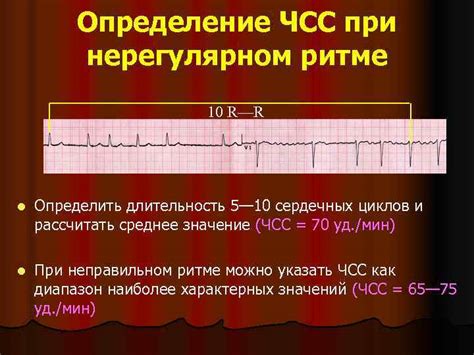 Осложнения при нерегулярном синусовом ритме