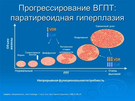 Осложнения терминальной стадии ВИЧ