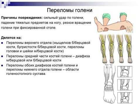 Основные аспекты спиц при переломе