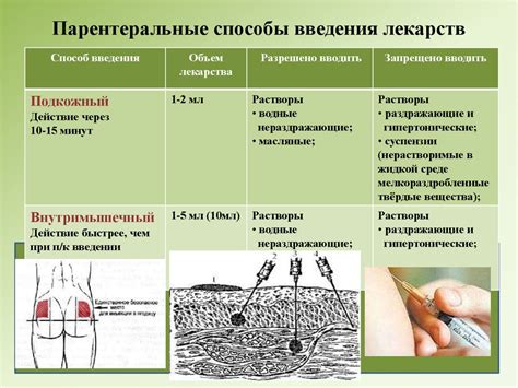 Основные виды парентерального введения лекарств