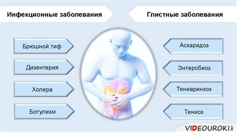 Основные заболевания, связанные с нарушением пищеварения