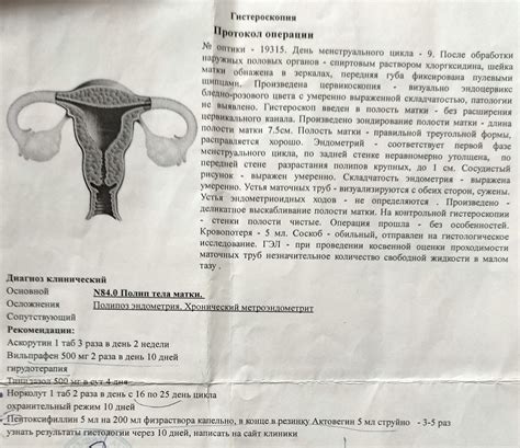 Основные методы лечения незначительного количества свободной жидкости