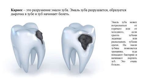 Основные мифы о ванночках для зуба и их разрушение