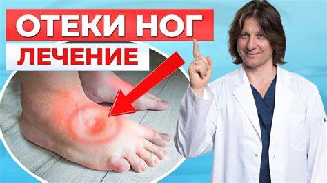 Основные направления лечения отека ног у ребенка