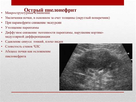 Основные патологии, выявляемые УЗИ почек