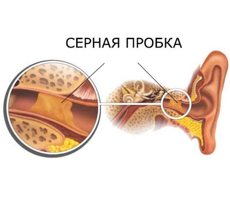 Основные признаки наличия черной серы в ушах