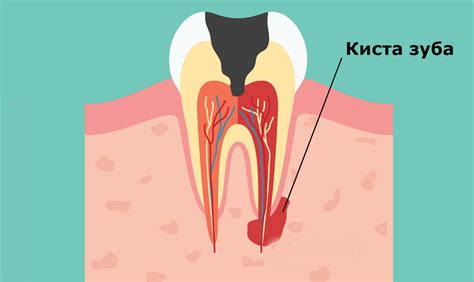 Основные признаки неоперабельной кисты