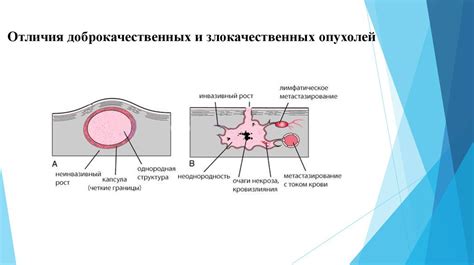 Основные признаки плотной опухоли