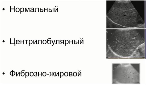 Основные причины гомогенной эхоструктуры печени