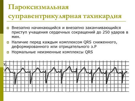 Основные причины наджелудочковой аритмии