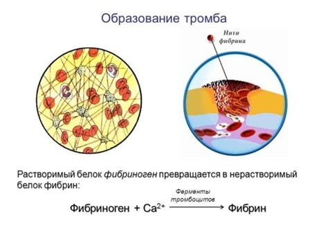 Основные причины повышенного уровня фибрина