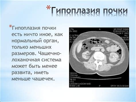 Основные симптомы гипоплазии почки у детей