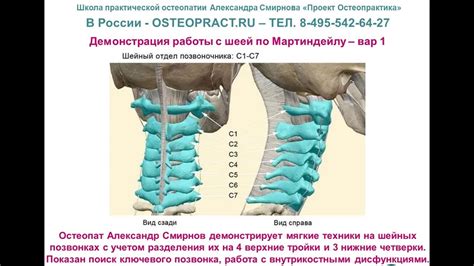 Основные симптомы и последствия проблем с шейными позвонками