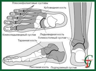 Основные симптомы некроза голеностопного сустава