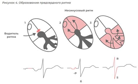 Основные симптомы нижнепредсердного ритма на ЭКГ