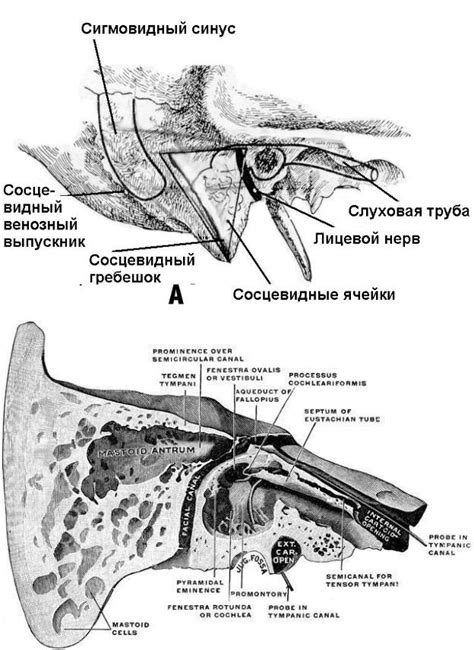 Основные симптомы склеротического типа сосцевидного отростка