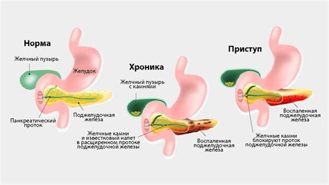 Основные симптомы язвища