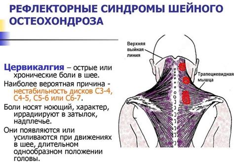 Основные факторы, вызывающие повышенное потоотделение в области шеи и затылка