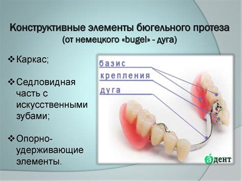 Основные характеристики бюгельных протезов