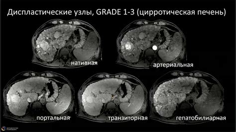 Особенности применения контрастного вещества