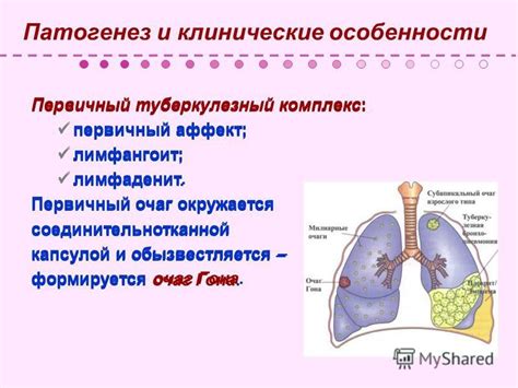 Особенности проявления гона