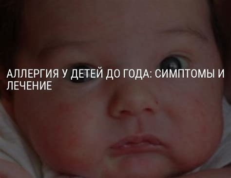 Особенности сэка у ребенка: причины и симптомы