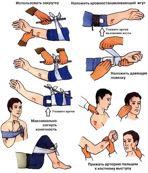Остановка кровотечения: как справиться с критической ситуацией?