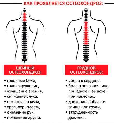 Остеохондроз: блокада и ее значение