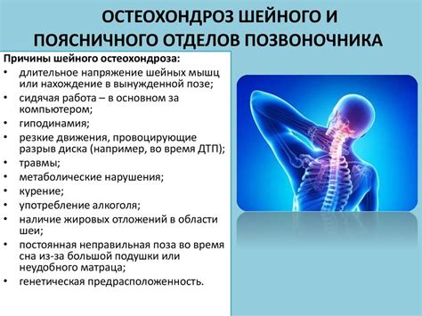 Остеохондроз шейного отдела позвоночника